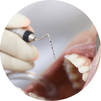 periodontal treatment cost