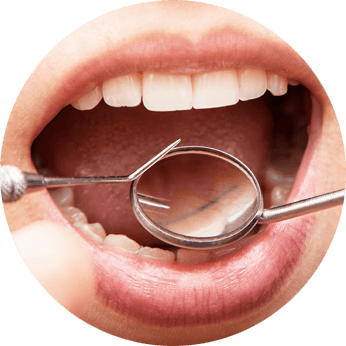 periodontitis treatment cost