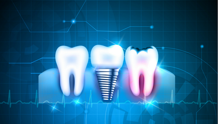 Digital-Dentistry