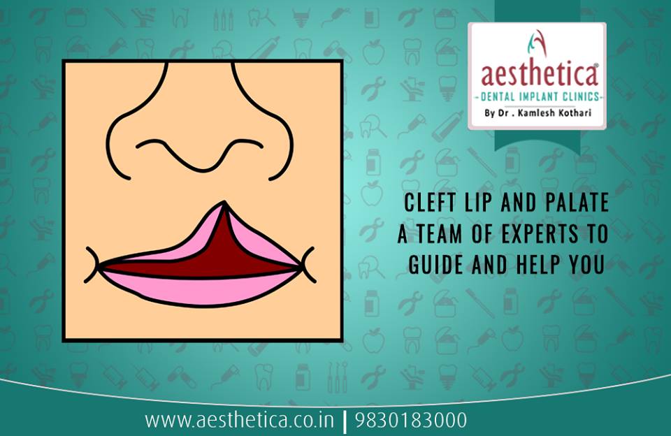 Cleft Lip and Cleft Lip Treatment in Kolkata