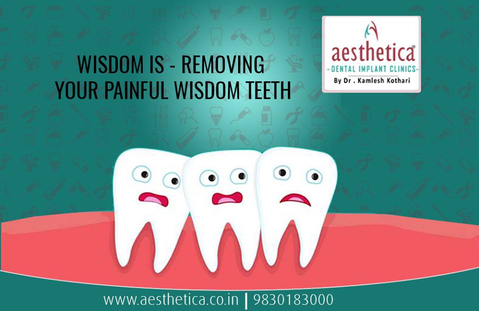 What is Wisdom Teeth Removal?