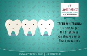 All about teeth whitening in kolkata