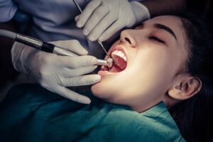 How Can You Pick a Root Canal Dentist?
