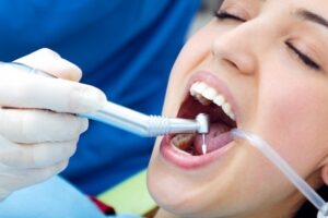 The Startling Benefits Of Dental Implants