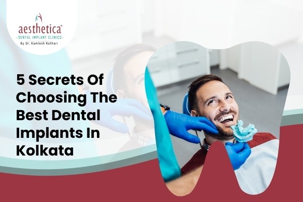 Man undergoing dental implants in Kolkata procedure