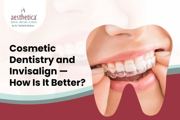Cosmetic Dentistry And Invisalign — How Is It Better?