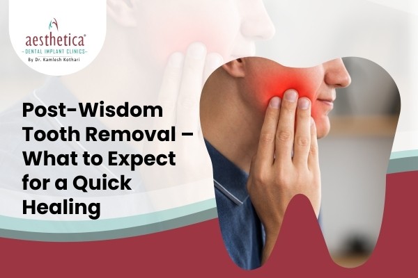 Wisdom Tooth Removal: Recovery Tips You Need To Know