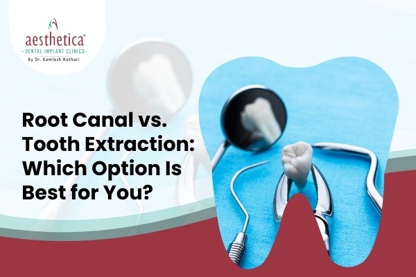 Root Canal vs. Tooth Extraction: Which Option Is Best for You?