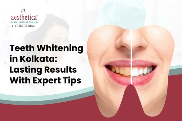 Teeth Whitening In Kolkata: Expert Tips For Lasting Results