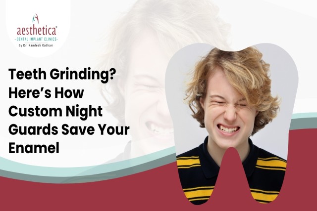 Teeth grinding protection with custom dental night guard