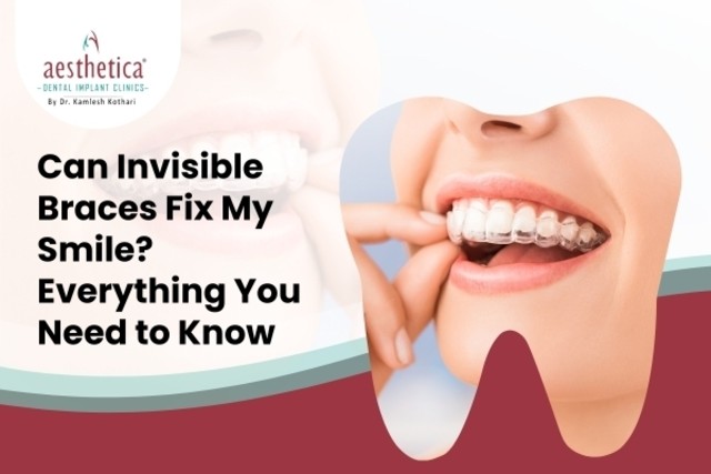 Invisible braces treatment in Kolkata