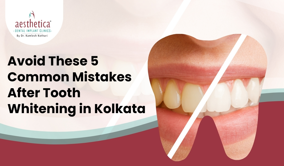 Close-up of bright smile after professional tooth whitening in Kolkata