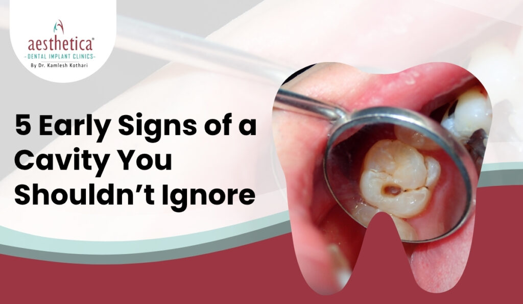 5 Early Signs Of A Cavity You Shouldn’t Ignore